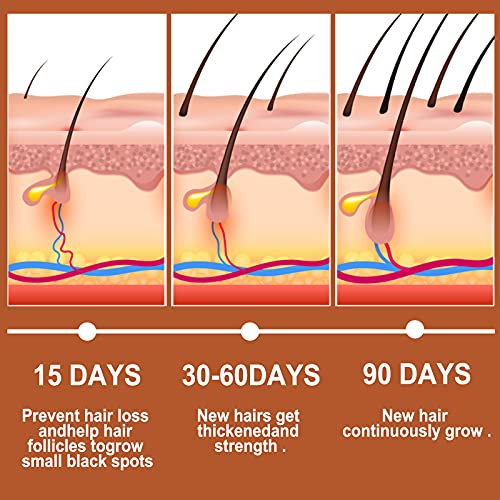 Saç İnceltme Erkekler ve Kadınlar için Saç Büyüme Serumu,Bitkisel Esansiyel Argan Yağı Zencefil Hızlı Saç Büyüme Serumu Saç Dökülmesini